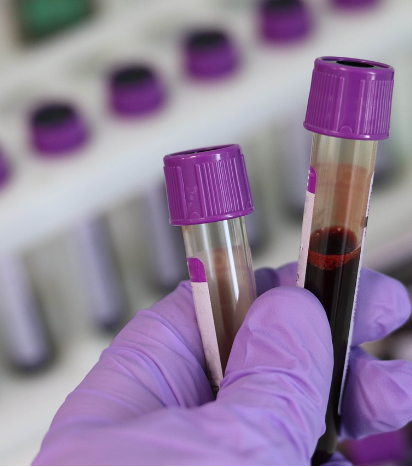 leaf_image_not_found